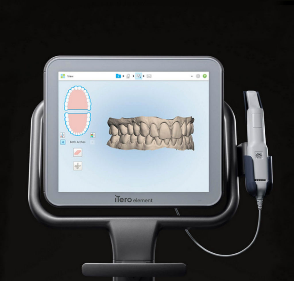 Invisalign ITERO ELEMENT SCANNER
